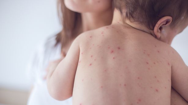 前护理人员解释了“拯救生命”的测试，显示孩子是否病得很重